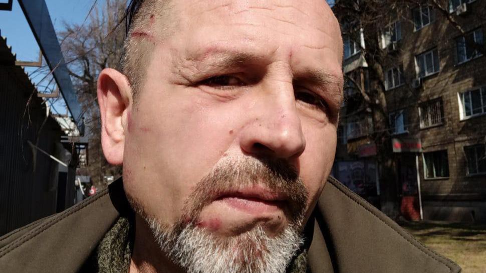 У Києві поліція розслідує інцидент із побиттям ветерана та кримського експолітв’язня Володимира Балуха в Шевченківському ТЦК